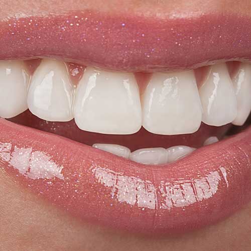 professional-teeth-cleaning-michigan